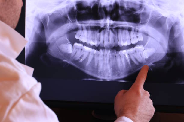 Tooth Infection Emergency Dentist in OH