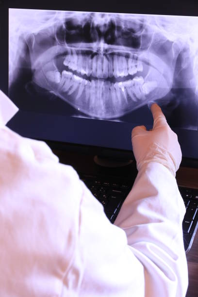 Best Teeth Whitening  in Ashville, OH