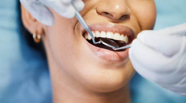 Best Chipped Tooth Repair Near Me  in Ashville, OH