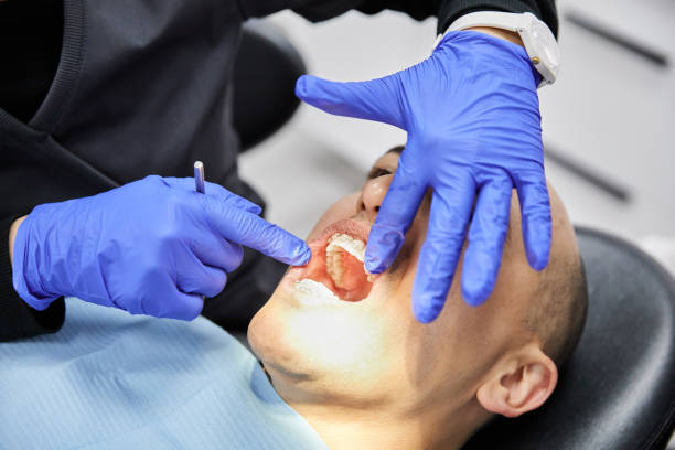 Best Tooth Infection Emergency Dentist  in Ashville, OH