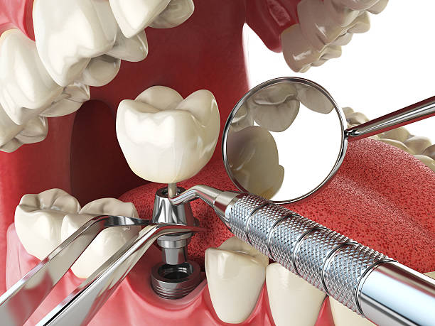 Best Emergency Gum Pain Relief  in Ashville, OH